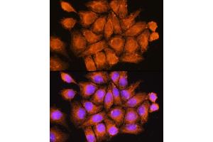 Immunofluorescence analysis of HeLa cells using CF Rabbit pAb (ABIN7266431) at dilution of 1:100.