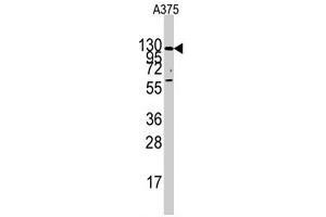 Western blot analysis of IDE polyclonal antibody  in A-375 cell line lysates (35 ug/lane). (IDE anticorps  (Internal Region))