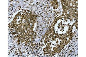 IHC analysis of SNRPN using anti-SNRPN antibody (ABIN3043934). (SNRPN anticorps  (N-Term))
