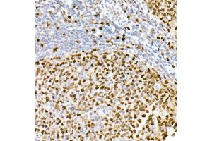 Immunohistochemistry of paraffin-embedded human tonsil using PCNA antibody (ABIN6133630, ABIN6139020, ABIN6139022 and ABIN7101400) at dilution of 1:2700 (40x lens). (PCNA anticorps)