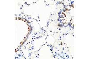 Immunohistochemistry of paraffin-embedded rat lung using NTF3 antibody (ABIN6290616) at dilution of 1:100 (40x lens). (Neurotrophin 3 anticorps)