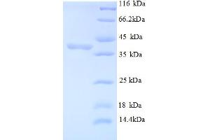 SDS-PAGE (SDS) image for Mindbomb E3 Ubiquitin Protein Ligase 1 (MIB1) (AA 5-332), (partial) protein (His tag) (ABIN5712848) (MIB1 Protein (AA 5-332, partial) (His tag))