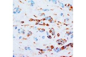 Image no. 1 for anti-Junction Plakoglobin (JUP) (N-Term) antibody (ABIN1494121)