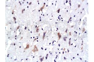 Formalin-fixed and paraffin embedded: rat brain tissue labeled with Anti-PKB Polyclonal Antibody, Unconjugated 1:200 followed by conjugation to the secondary antibody and DAB staining (AKT1/3 (AA 401-479) anticorps)