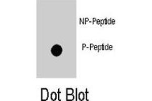 Dot blot analysis of ZBTB16 (phospho Y334) polyclonal antibody  on nitrocellulose membrane. (ZBTB16 anticorps  (pTyr334))