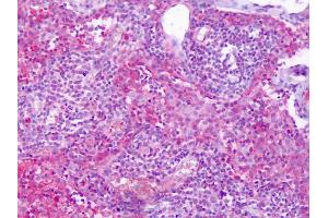 Anti-S1PR4 / EDG6 antibody IHC of human lymph node.