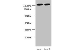 Western blot All lanes: MCM9 antibody at 0. (MCM9 anticorps  (AA 1-391))
