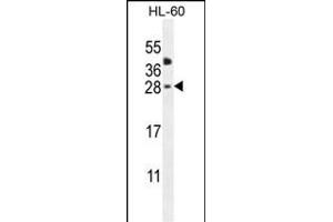 CLEC2A Antibody (Center) (ABIN655012 and ABIN2844646) western blot analysis in HL-60 cell line lysates (35 μg/lane). (CLEC2A anticorps  (AA 79-107))