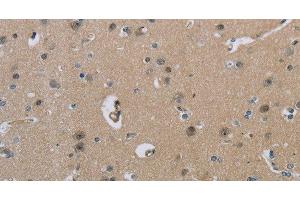 Immunohistochemistry of paraffin-embedded Human brain using HSD3B1 Polyclonal Antibody at dilution of 1:40