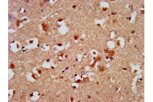 IHC image of ABIN7146458 diluted at 1:500 and staining in paraffin-embedded human brain tissue performed on a Leica BondTM system. (Calcyphosine 2 anticorps  (AA 191-274))