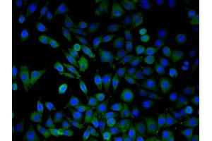 SMMC7721 cells were stained with ARMC3 Polyclonal Antibody, Unconjugated  at 1:50 in PBS and incubated for one hour at room temperature, followed by secondary antibody incubation, DAPI staining of the nuclei and detection. (ARMC3 anticorps  (AA 752-840))