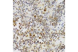 Immunohistochemistry of paraffin-embedded human appendicitis using NASP Antibody.