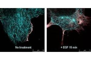 Immunofluorescence (IF) image for anti-V-Akt Murine Thymoma Viral Oncogene Homolog 1 (AKT1) (Ser473) antibody (ABIN400784) (AKT1 anticorps  (Ser473))