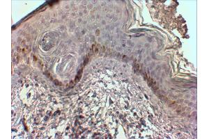 ABIN768626 (2µg/ml) staining of paraffin embedded Human Skin.