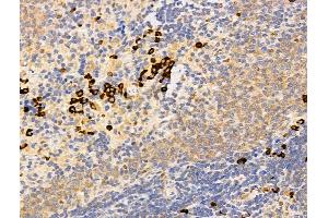 ABIN7094787 and ABIN7098838 at 1/100 staining Rat spleen tissue by IHC-P.