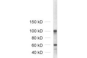 Western Blotting (WB) image for anti-Neuroligin 1/2/3/4 (NLGN1/2/3/4) (AA 1-695) antibody (ABIN1742285) (Neuroligin 1/2/3/4 anticorps  (AA 1-695))