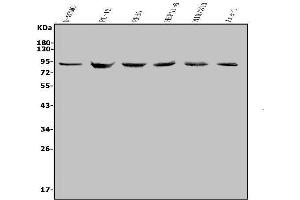 Western blot analysis of MDM2 using anti-MDM2 antibody (ABIN7603183).
