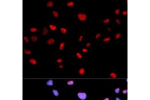 Immunofluorescence analysis of MCF-7 cells using Phospho-CDK1(T161) Polyclonal Antibody (CDK1 anticorps  (pThr161))