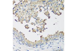Immunohistochemistry of paraffin-embedded human prostate using NEDD4L antibody. (NEDD4-2 anticorps)