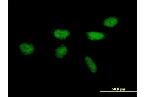 Immunofluorescence of purified MaxPab antibody to XPA on HeLa cell. (XPA anticorps  (AA 1-273))