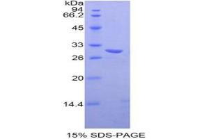 SDS-PAGE analysis of Mouse TXK Tyrosine Kinase Protein. (TXK Protéine)