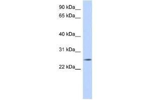 Western Blotting (WB) image for anti-Na+/K+ Transporting ATPase Interacting 4 (NKAIN4) antibody (ABIN2459631) (NKAIN4 anticorps)