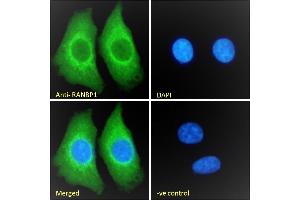 (ABIN185257) Immunofluorescence analysis of paraformaldehyde fixed HEK293 cells, permeabilized with 0.