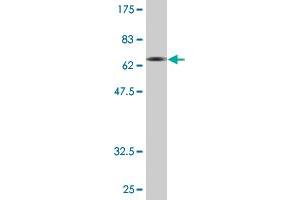 Western Blot detection against Immunogen (72.