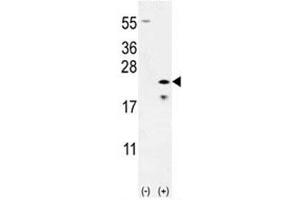 Western blot analysis of Bax antibody and 293 cell lysate (2 ug/lane) either nontransfected (Lane 1) or transiently transfected (2) with the Bax gene. (BAX anticorps  (AA 41-76))