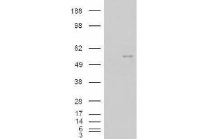 Western Blotting (WB) image for Neuro-Oncological Ventral Antigen 1 (NOVA1) peptide (ABIN369762) (Neuro-Oncological Ventral Antigen 1 (NOVA1) Peptide)