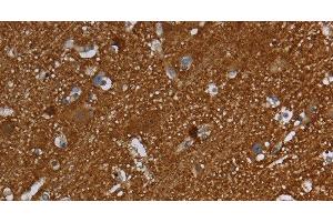 Immunohistochemistry of paraffin-embedded Human brain using SNCG Polyclonal Antibody at dilution of 1:60