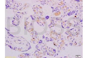 Formalin-fixed and paraffin embedded human placenta labeled with Anti-ADFP Polyclonal Antibody, Unconjugated (ABIN738606) at 1:200 followed by conjugation to the secondary antibody and DAB staining.