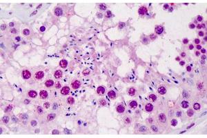Human Testis: Formalin-Fixed, Paraffin-Embedded (FFPE)