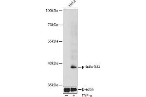 Western blot analysis of extracts of HeLa cells, using Phospho-IκBα-S32 antibody (ABIN6135267, ABIN6136154, ABIN6136155 and ABIN6225645) at 1:1000 dilution. (NFKBIA anticorps  (pSer32))