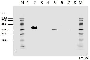 Cell lyzates of HEK293T/17 cells transiently transfected with expression vectors harboring genes for mCD3zeta wild type and six different mCD3zeta mutants, where particular ITAM tyrosines were substituted with phenylalanines, were prepared.