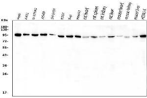Western blot analysis of VCP using anti-VCP antibody (ABIN3043958).