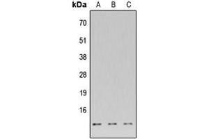 Western blot analysis of DNAL4 expression in HeLa (A), Raw264.