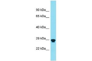 Host: Rabbit Target Name: RNF151 Sample Type: THP-1 Whole Cell lysates Antibody Dilution: 1.