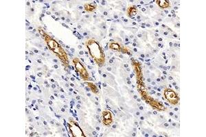 Immunohistochemistry analysis of paraffin-embedded rat kidney using,SLC12A1 (ABIN7075651) at dilution of 1: 2000 (SLC12A1 anticorps)