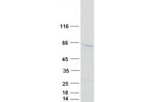 Validation with Western Blot