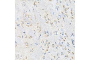 Immunohistochemistry of paraffin-embedded mouse brain using CHIC2 antibody (ABIN5974773) at dilution of 1/100 (40x lens). (CHIC2 anticorps)