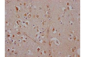 IHC image of ABIN7127325 diluted at 1:100 and staining in paraffin-embedded human brain tissue performed on a Leica BondTM system.
