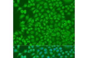 Immunofluorescence analysis of U2OS cells using BIRC3 Polyclonal Antibody at dilution of 1:100. (BIRC3 anticorps)