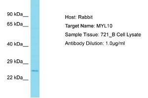 Host: Rabbit Target Name: MYL10 Sample Type: 721_B Whole Cell lysates Antibody Dilution: 1. (MYL10 anticorps  (N-Term))