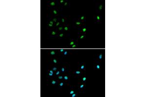 Immunofluorescence analysis of A549 cells using RUNX1 antibody. (RUNX1 anticorps)