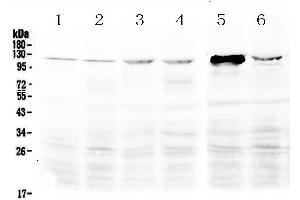 Western blot analysis of DDX58 using anti-DDX58 antibody .