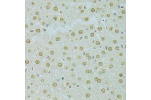 Immunohistochemistry of paraffin-embedded rat liver using RCC1 antibody (ABIN5973761) at dilution of 1/100 (40x lens). (RCC1 anticorps)