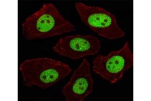 Immunofluorescent analysis of A549 cells using LIN28A antibody at 1:100.