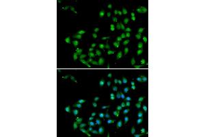 Immunofluorescence analysis of U2OS cells using CTNNBL1 antibody .