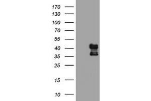 Western Blotting (WB) image for anti-Prenyl (Decaprenyl) Diphosphate Synthase, Subunit 2 (PDSS2) antibody (ABIN1500136)